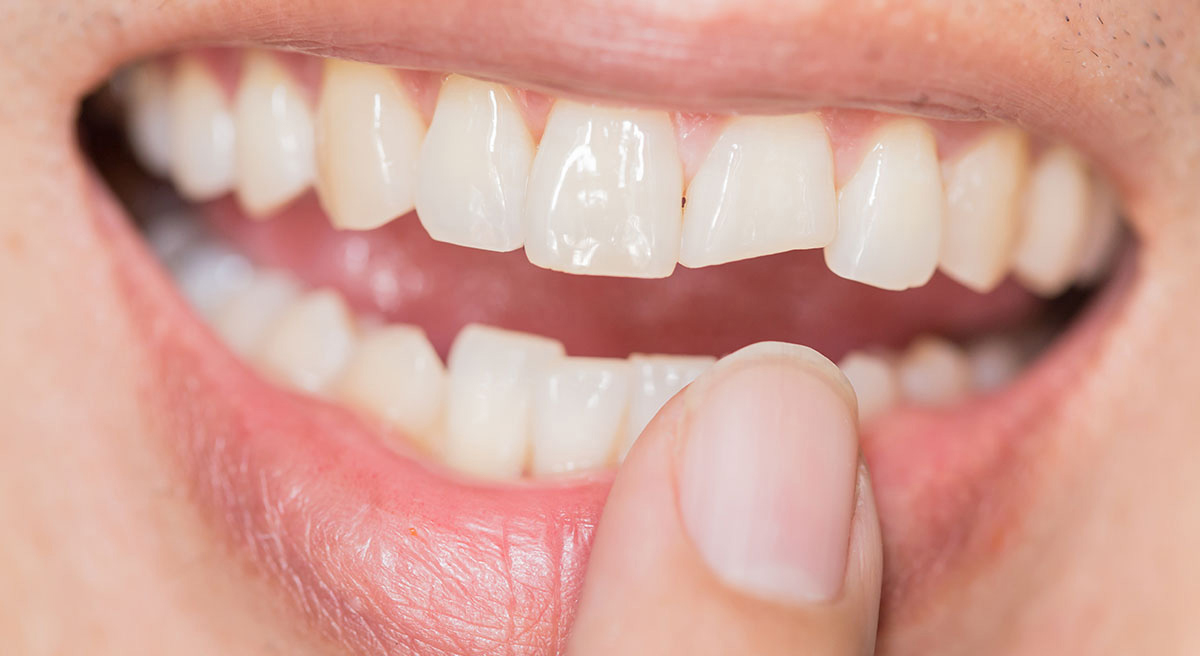 Зубы человека выполняют целый ряд важных функций