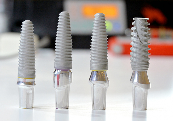 Рейтинг зубных имплантов