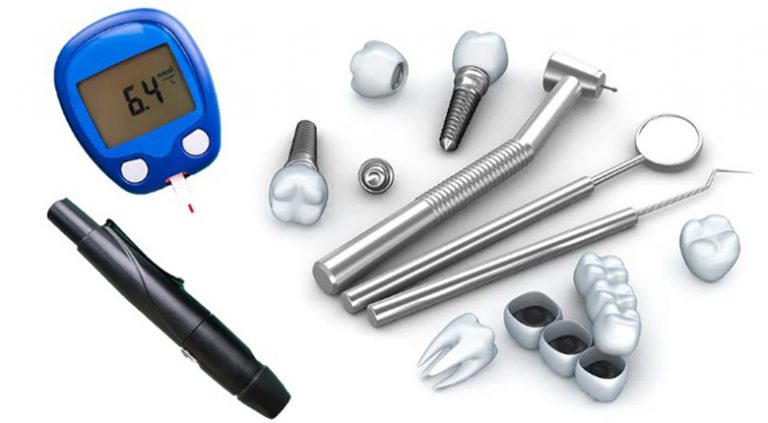 Имплантация при сахарном диабете