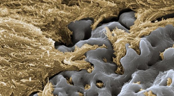 Процесс сращивания импланта с костной тканью пациента